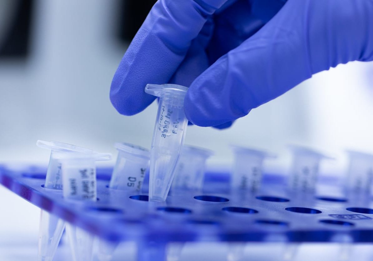 Polymerase Chain Reaction (PCR) and Agarose gel electrophoresis is a method of gel electrophoresis used in biochemistry, molecular biology, genetics, and clinical chemistry in lab.